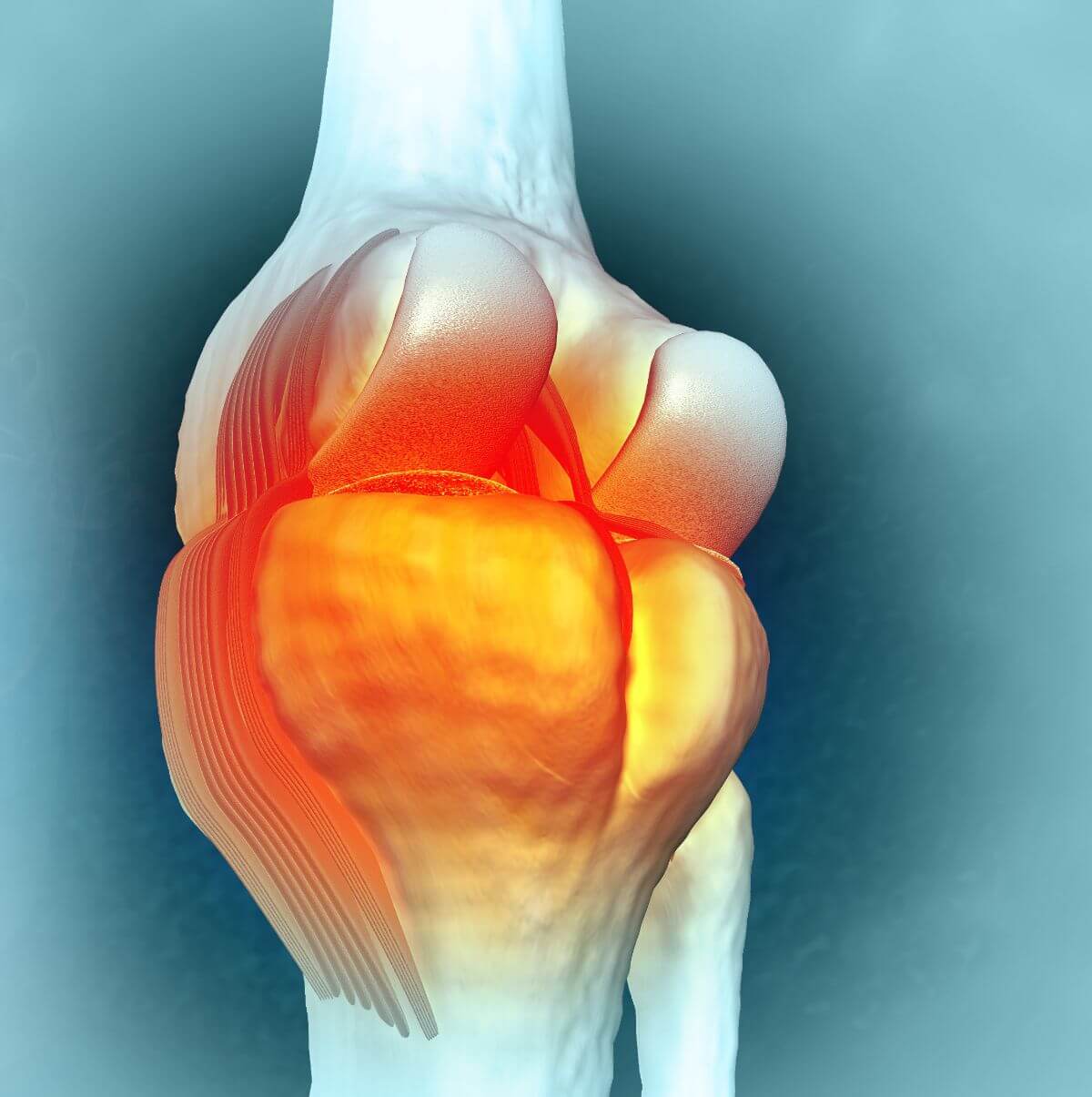 Osteoarthritis Oa Of The Knee Los Angeles Ca Dr Jason Snibbe