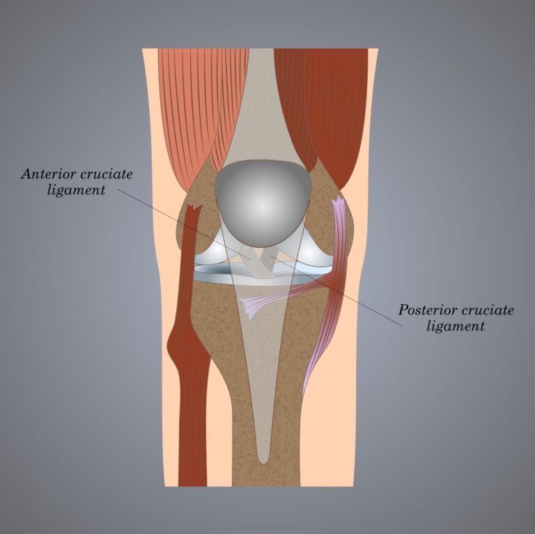 Arthroscopic ACL Reconstruction Los Angeles CA Dr Jason Snibbe