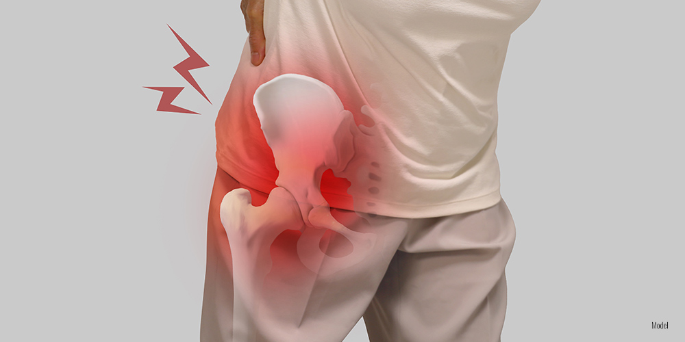 Feature Image: What Happens if You Don’t Repair a Hip Labral Tear?